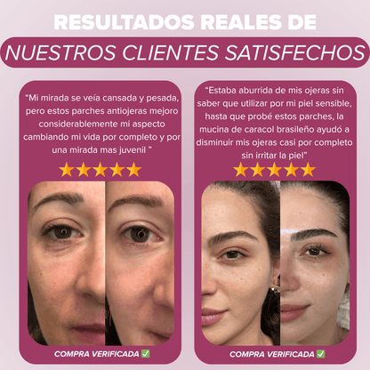 Eliminador anti ojeras mucina caracol brasileña
